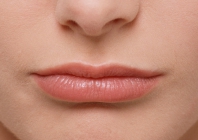 Lūpų putlinimas: pati geidžiamiausia moterų procedūra?
